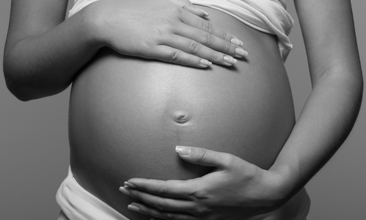 Using tallow balm for stretch mark prevention