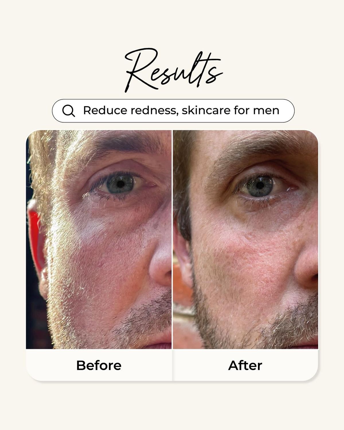 Before and after comparison of a man's face with skincare product results.